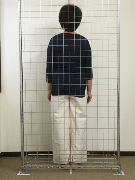 施術内容1